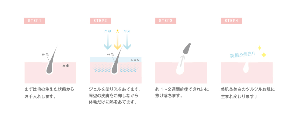 脱毛がはじめての方でも安心