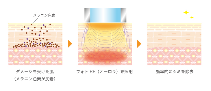 フォトRFとは？