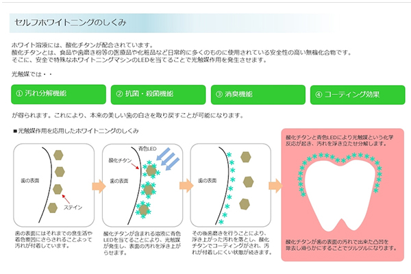 セルフホワイトニング